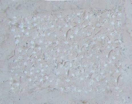 Basole picconate